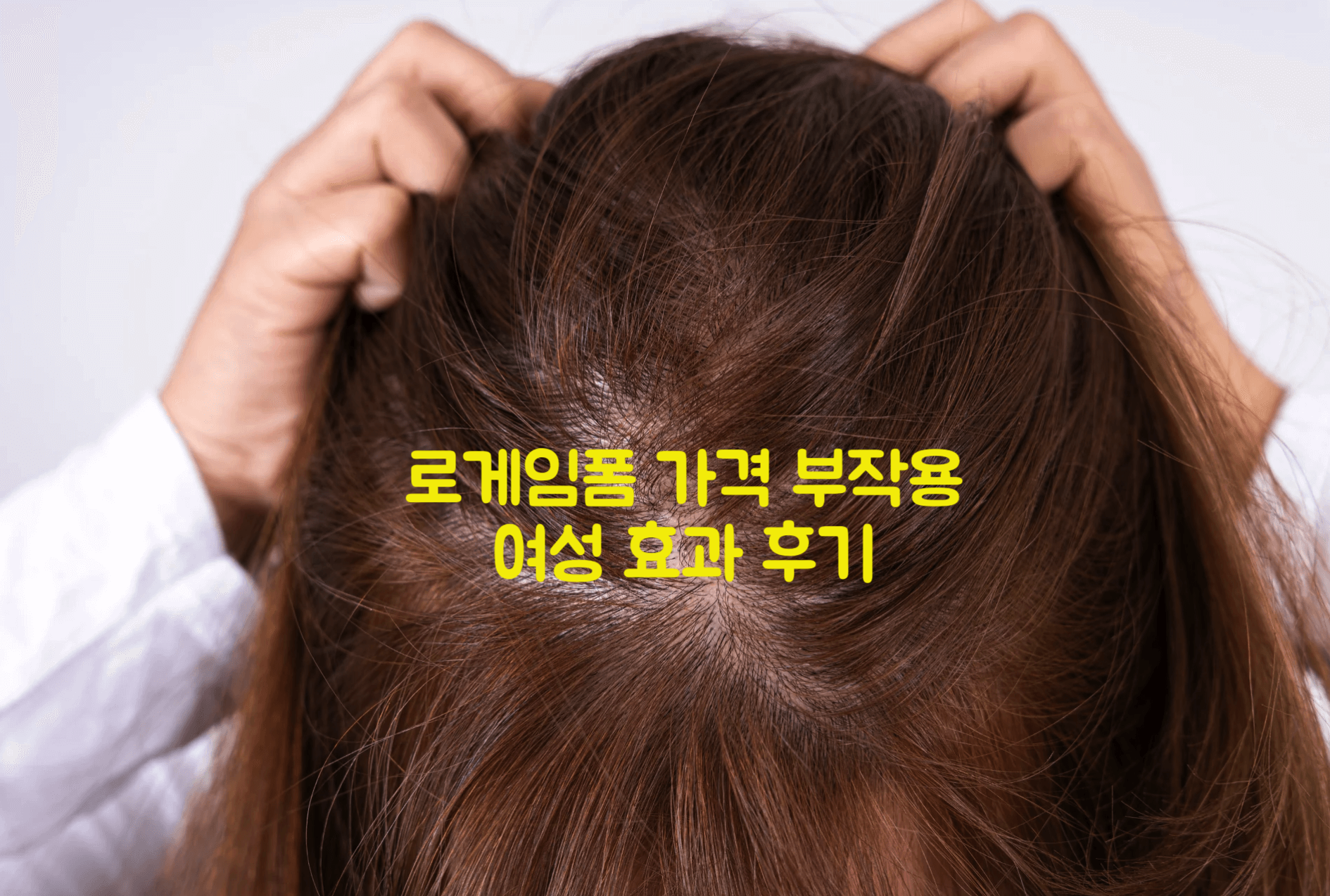 로게인폼 가격