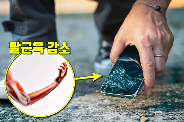 근육이 감소할때 증상,근감소증,손에힘빠짐