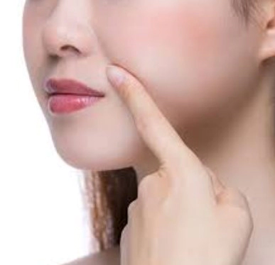 팔자주름 없애는 방법