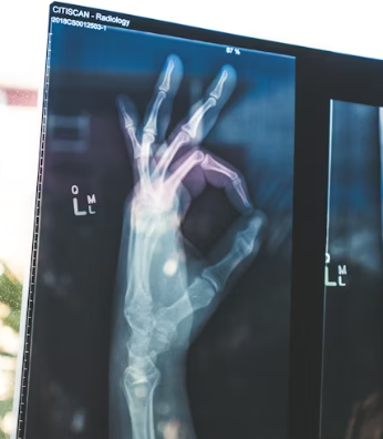 칼슘 하루 권장량 성인 1일 섭취방법