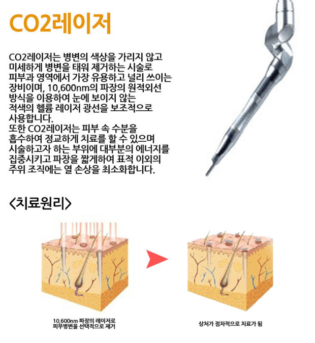 이산화탄소 레이저 원리