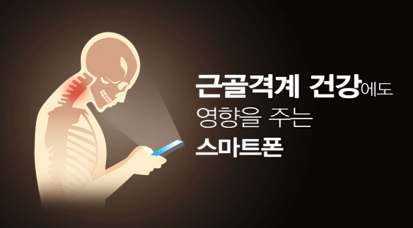 거북목 발생 1