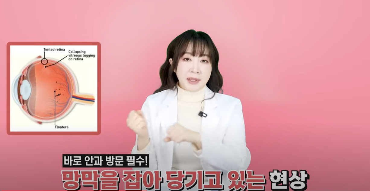 망막을 잡아당기는 현상