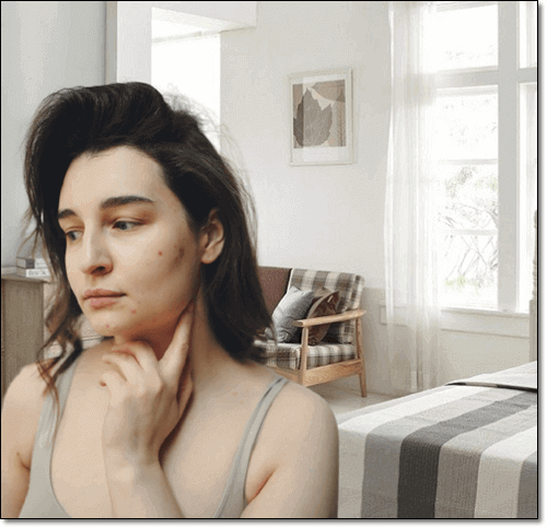 피부 염증이 있는 여성