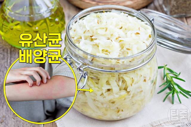 습진에 좋은음식 안좋은음식 자우어크라우트