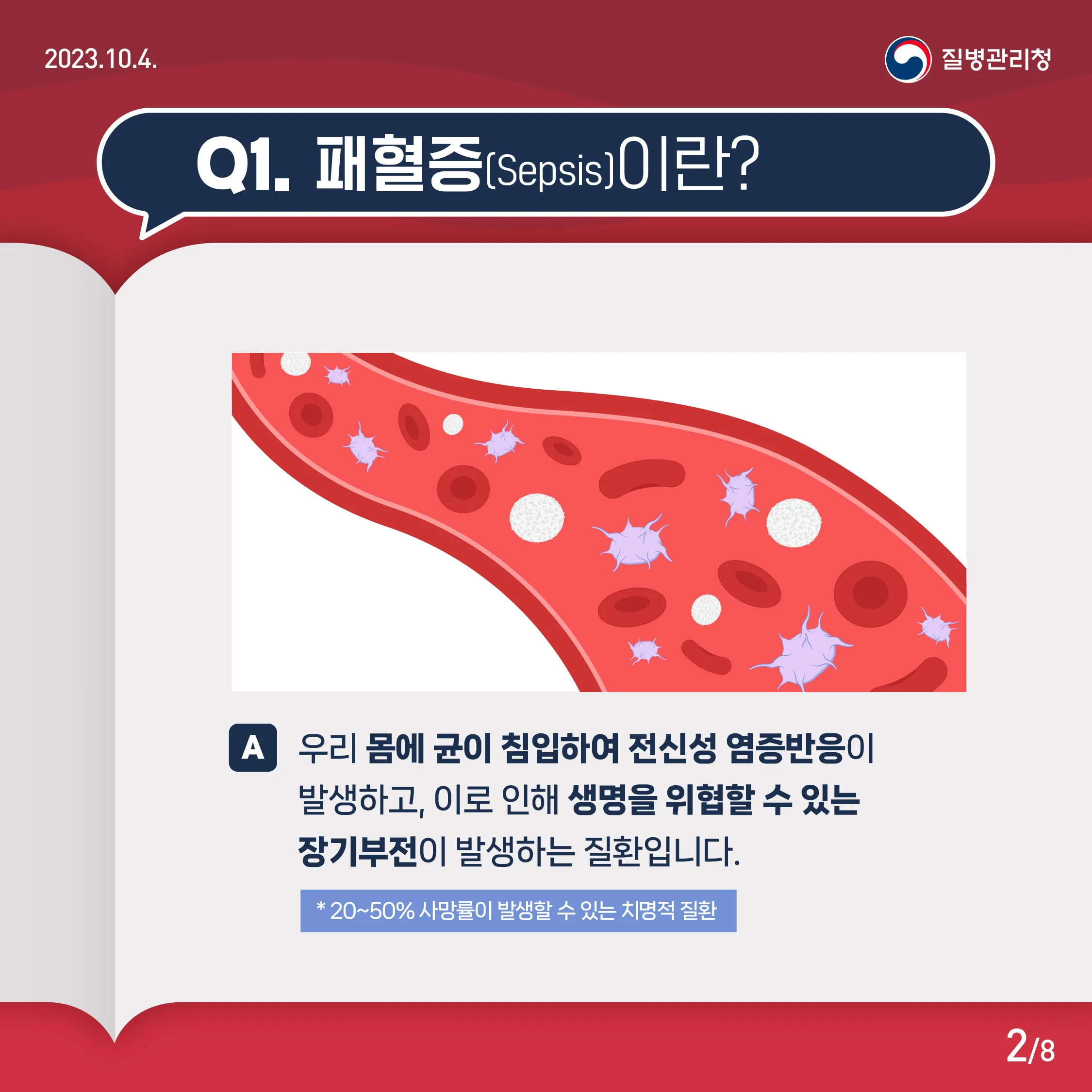 패혈증이란 무엇인지 원인 증상 치료 예방법_3
