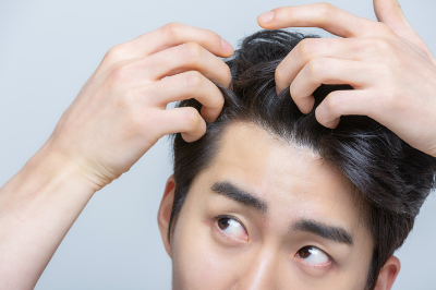 탈모에 놀란 남성