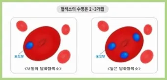 당화혈색소 정상치_21