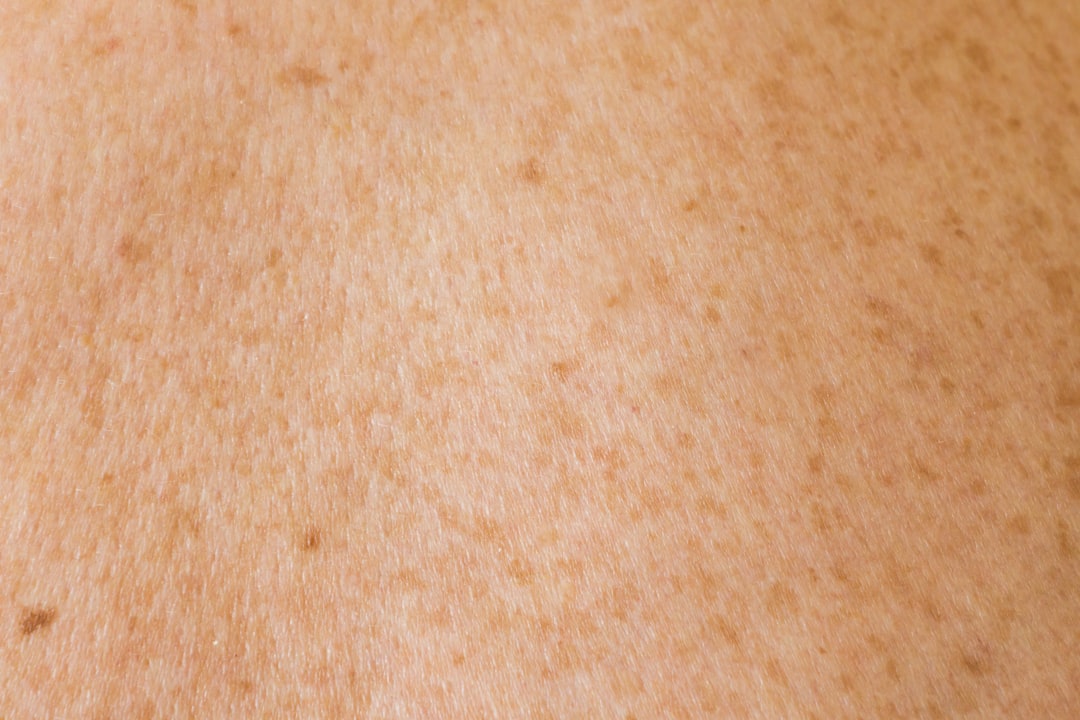 Skin Botox