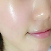 주름이 사라진다고 해서&amp;#44; 마데카솔과 바세린을 섞어서 발라보니 나아진 거 같기도 하고