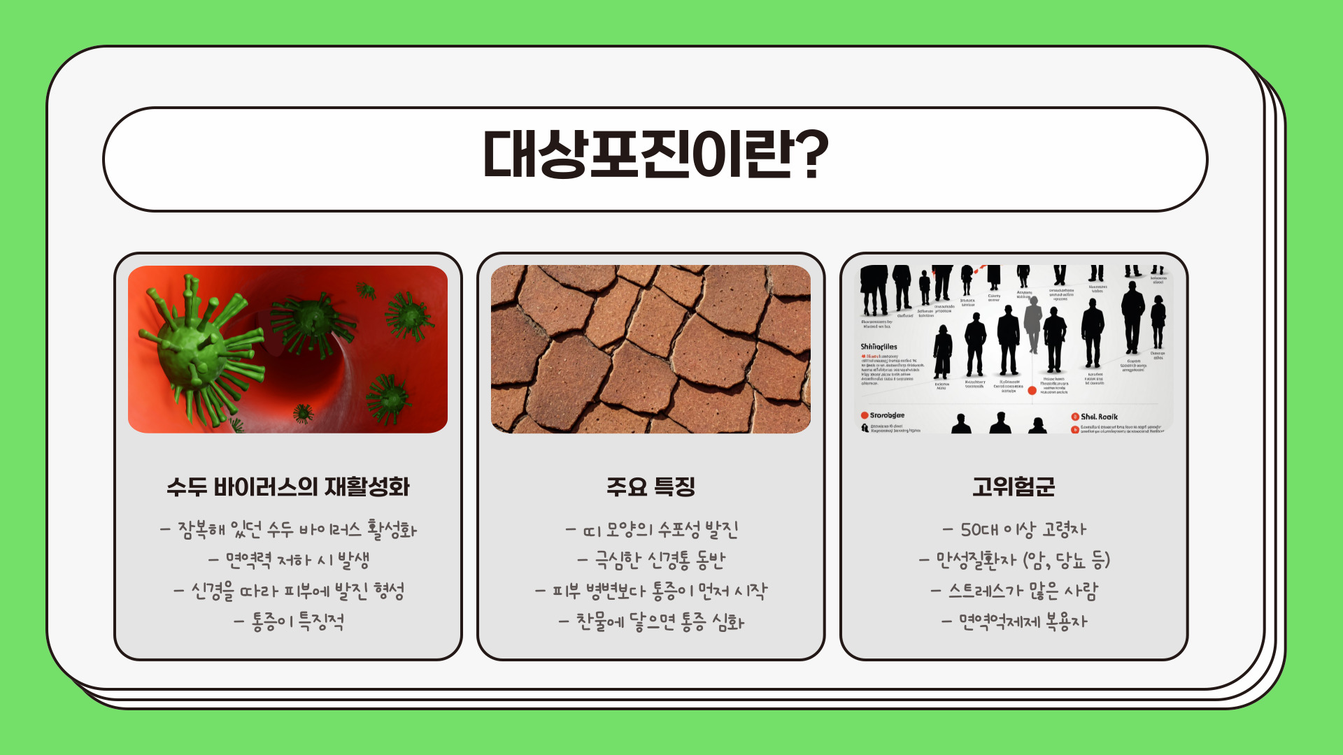 대상포진 초기증상