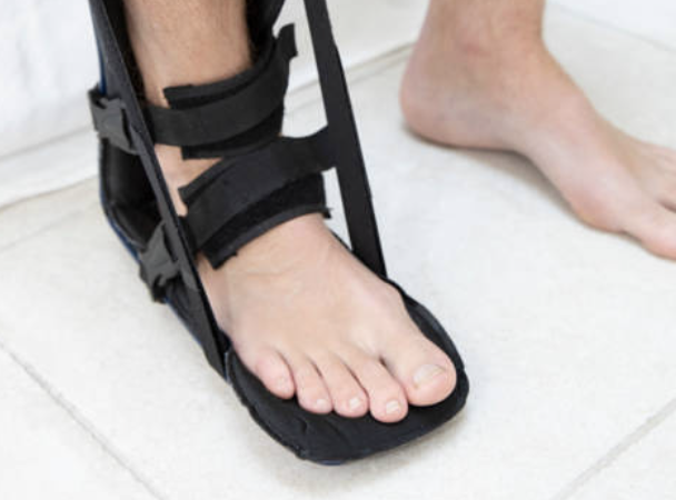 발바닥통증의 원인 35