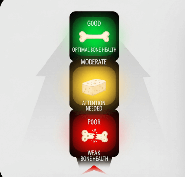 골밀도 검사 비용과 방법 안내14