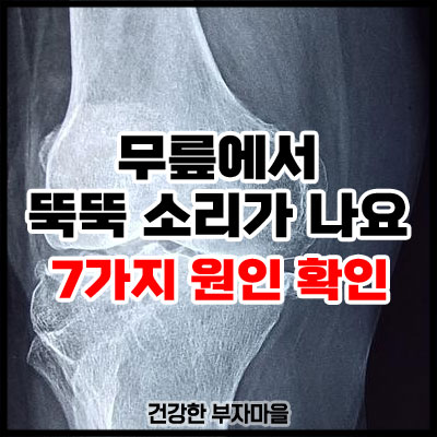 무릎에서 뚝뚝 소리가 나요