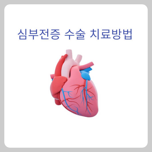 심부전증-수술치료방법-심장