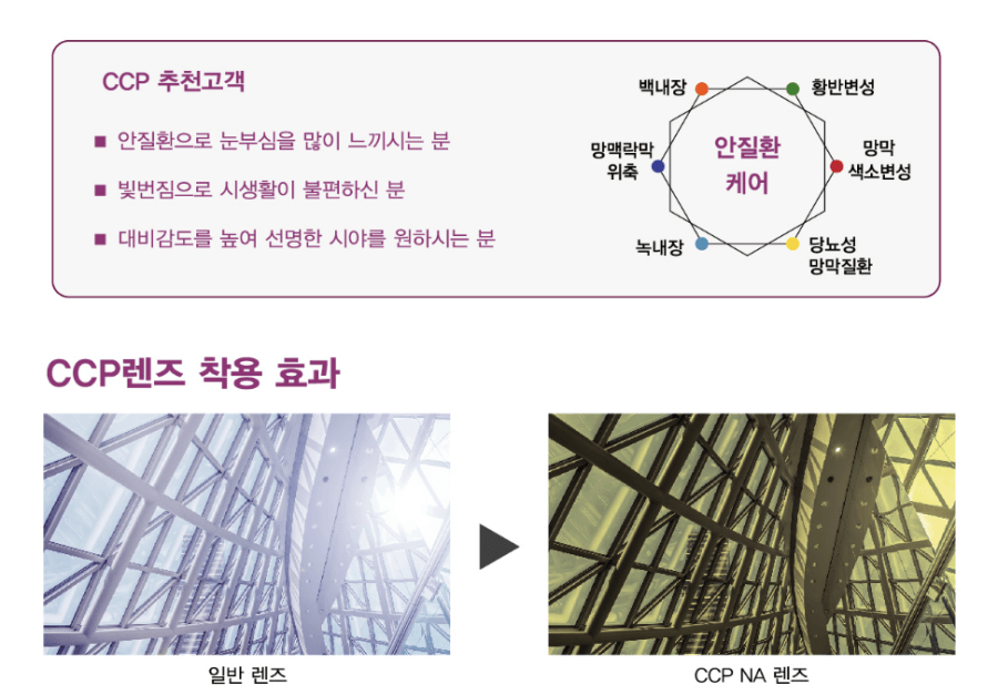 루티나-필컬러-렌즈가-필요한-사람