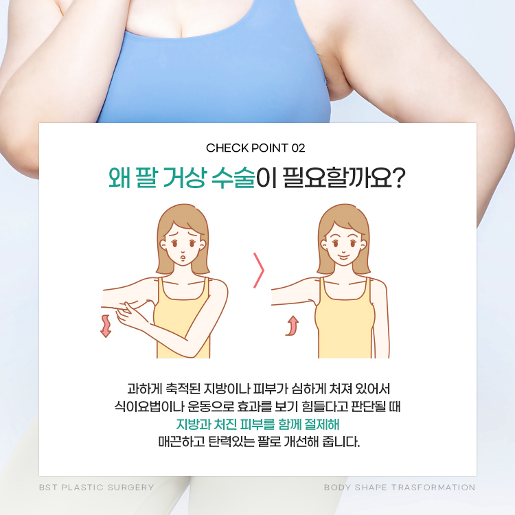 과하게 축적된 지방이나 피부가 심하게 처져 있어서 식이요법이나 운동으로 효과를 보기 힘들다고 판단될 때 지방과 처진 피부를 함께 절제해 매끈하고 탄력있는 팔로 개선해줍니다.