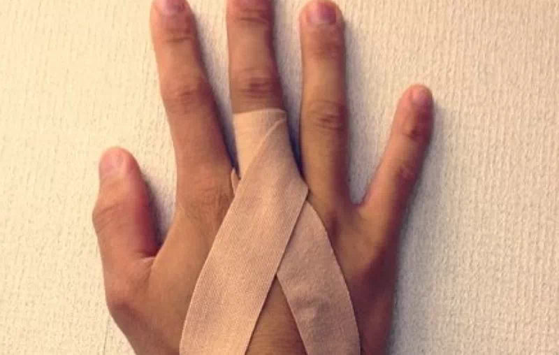 손가락 인대 늘어남 압박붕대