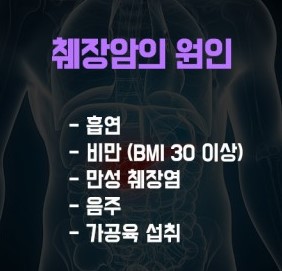 췌장암의 원인과 증상