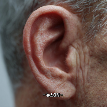 귓볼에 주름