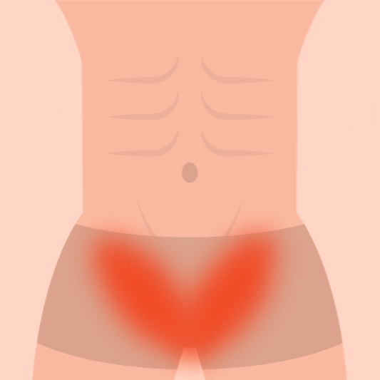 사타구니-가려움증-예시-이미지