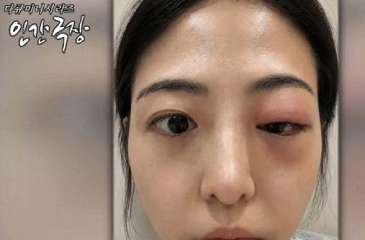 인간극장-김빛날윤미