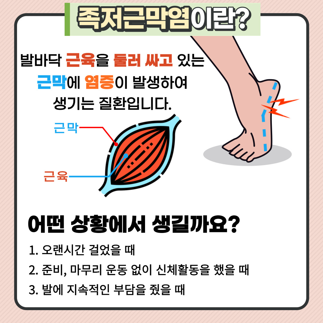 족저근막염 깔창 효과 전후 발 건강 개선