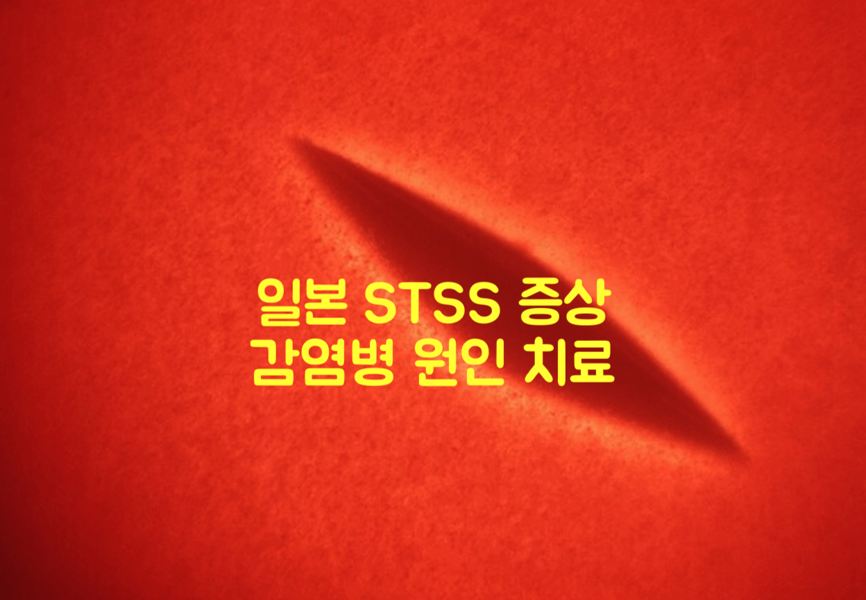 일본 STSS