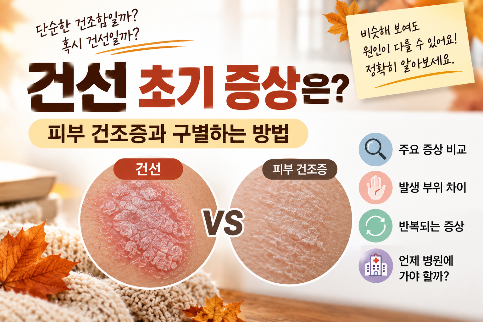 건선초기증상