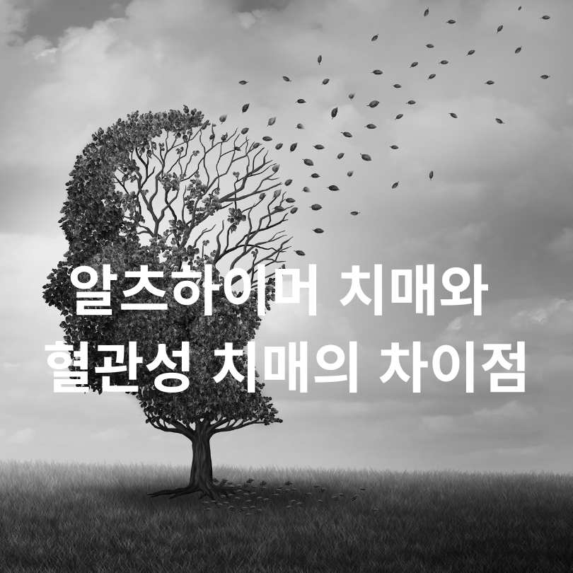 알츠하이머 치매와 혈관성 치매의 차이점