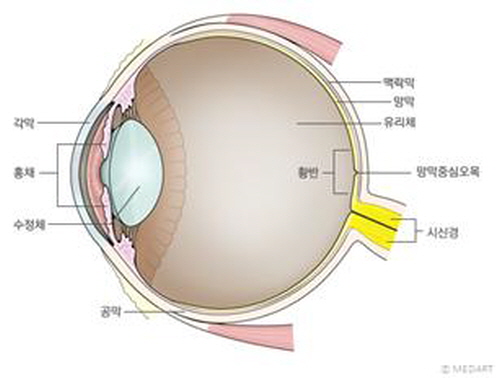 야맹증 증상