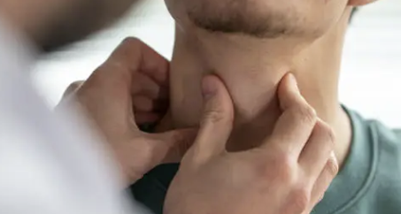 임파선염 증상 5