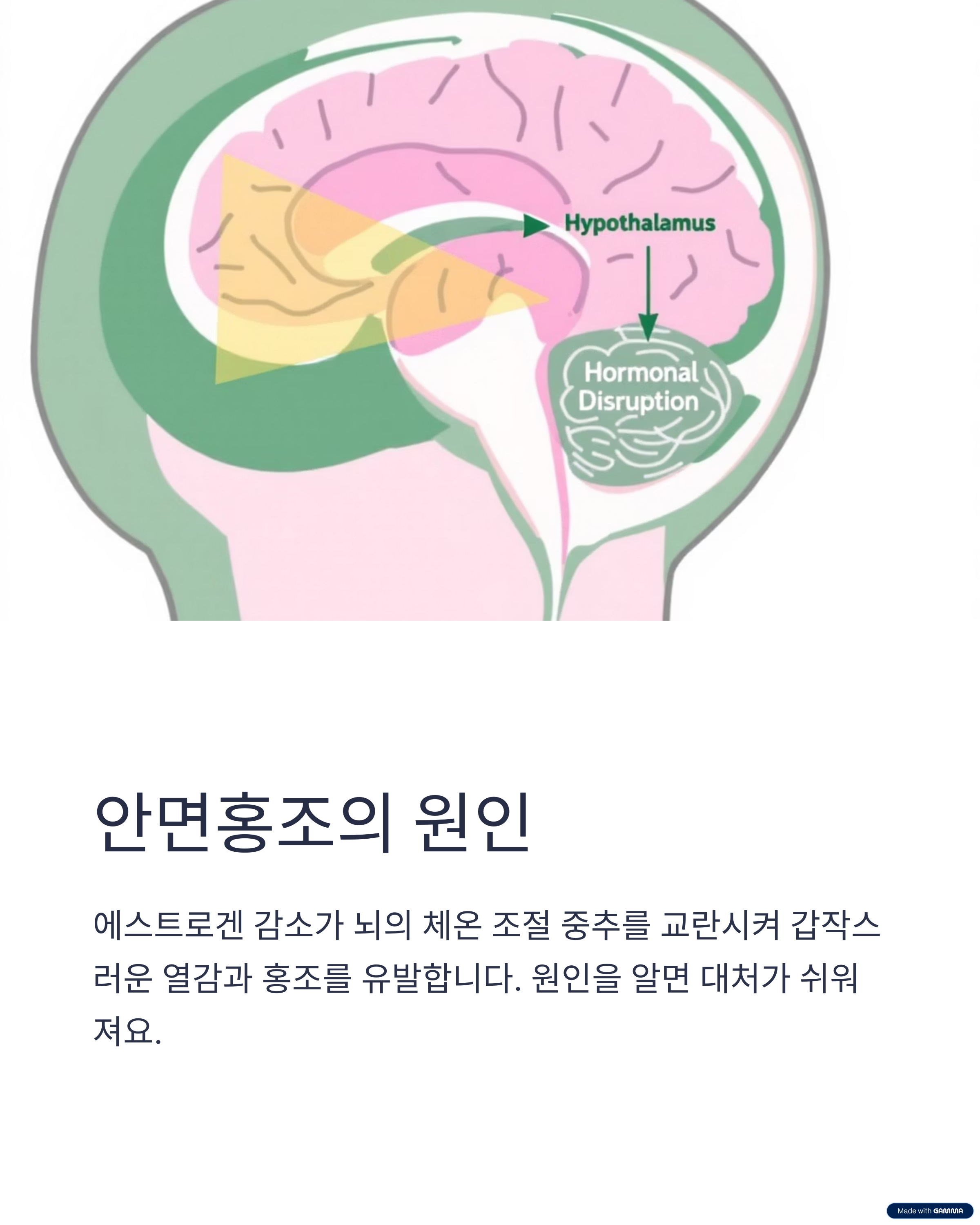 안면홍조의 원인