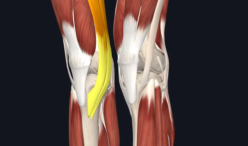 거위발 건염 원인과 증상 무릎 안쪽 통증 치료법 정리_4