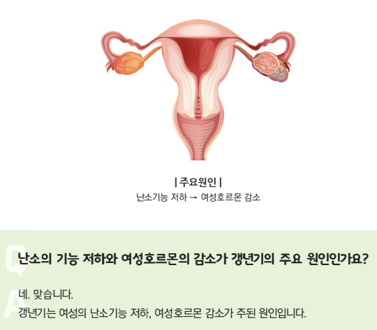 갱년기의 주요원인