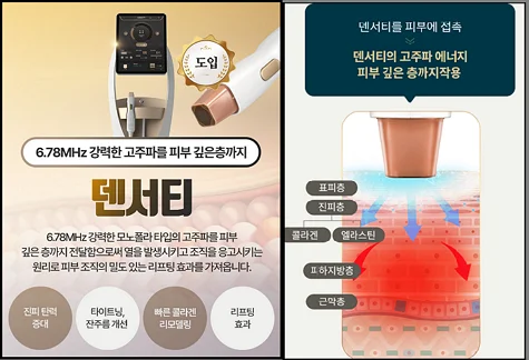 강남 써마지