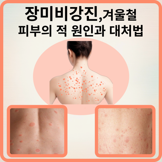 장미비강진