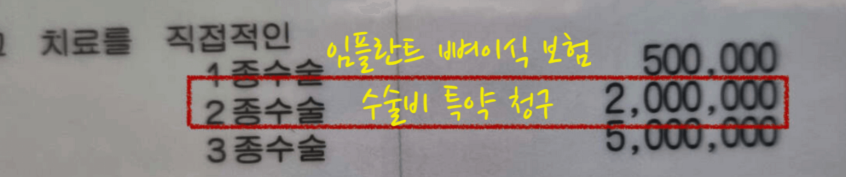 뼈이식 수술비 특약