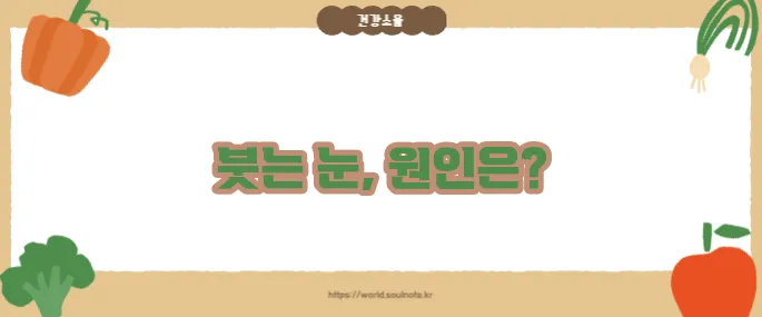 눈이 붓는 증상 (+부기 원인 총정리)