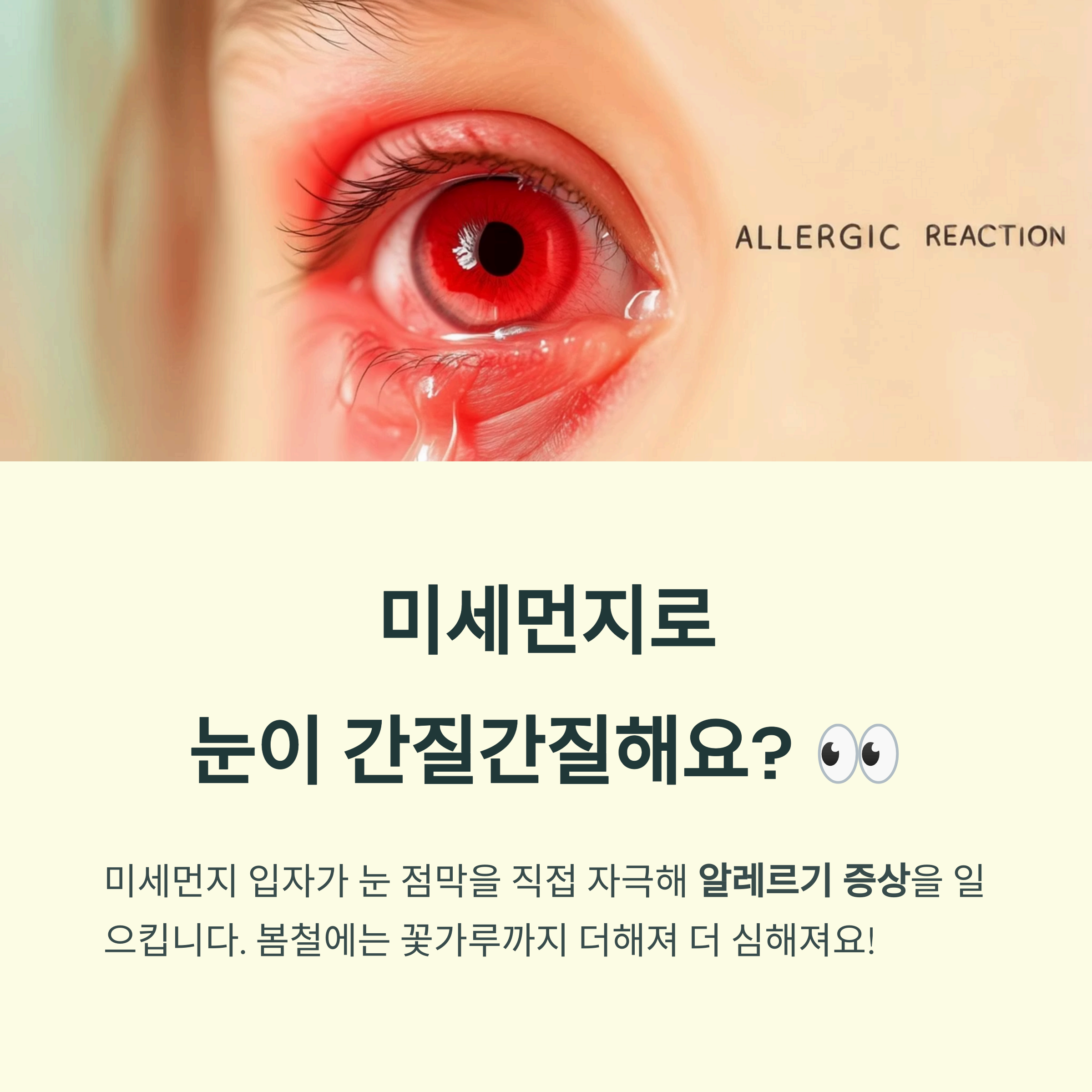 미세먼지로 눈이 간질간질해요