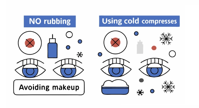 앞트임 수술 과정