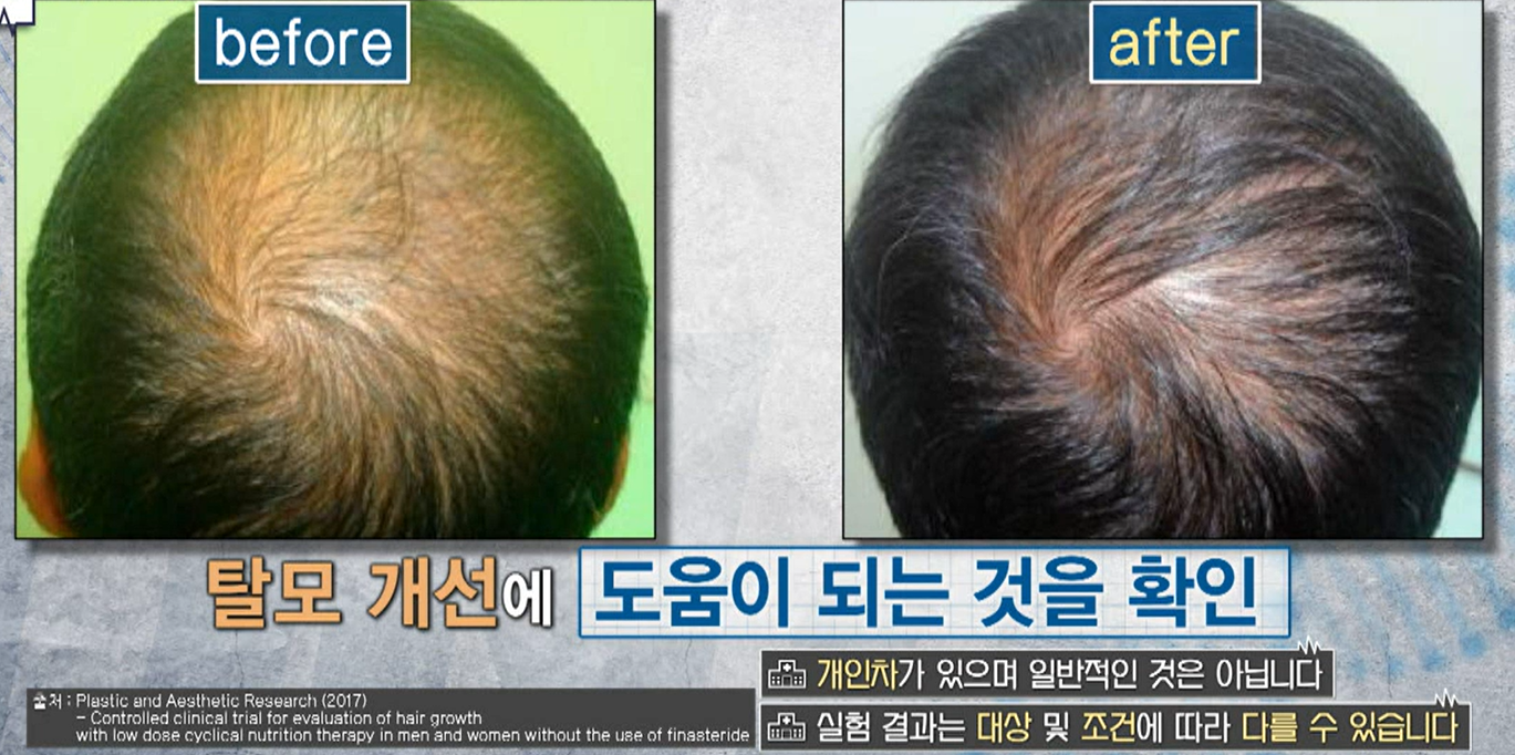 비오틴 효능