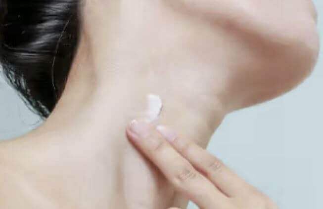 쥐젖 제거 연고를 바르는 모습