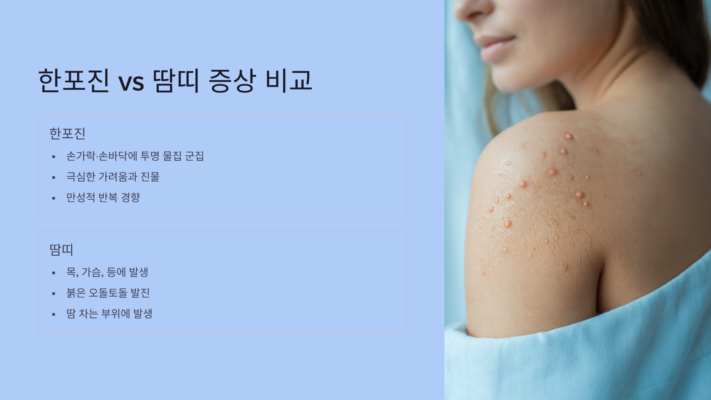 한포진 vs 땀띠, 증상 비교