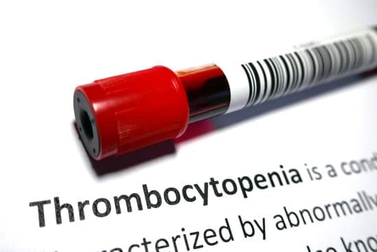 혈소판감소증 [Thrombocytopenia]에 대한 이해