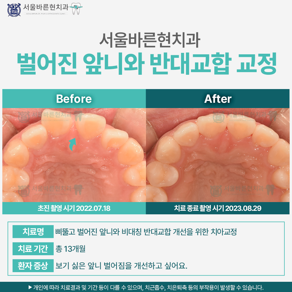 부산교정치과