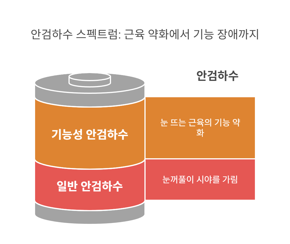 기능성 안검하수란 무엇인가요?