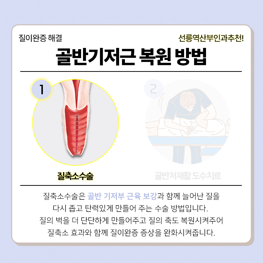 골반기저근 운동 질이완증 해결 진짜 되나요?