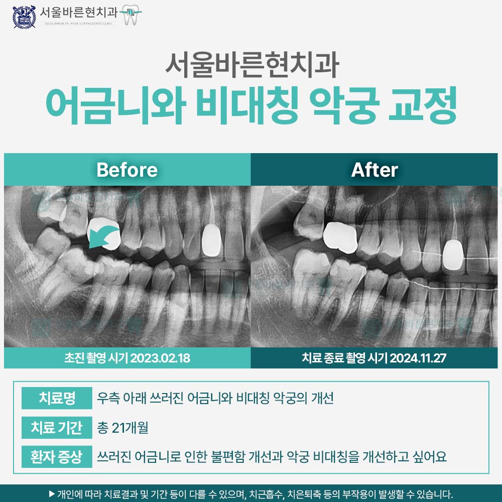 해운대교정치과