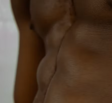 체지방률 정상범위